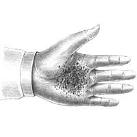 Img3